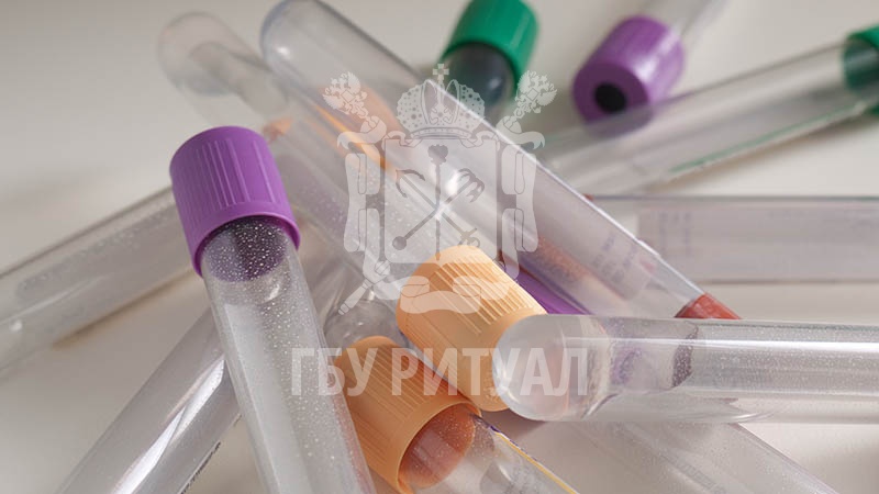 С какой группой крови чаще умирают от COVID-19